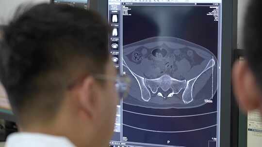 医院医生骨科影像分析讨论