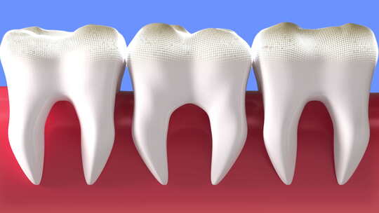 口腔卫生健康牙齿上一代牙齿美白过程3D动