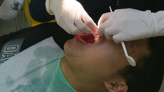 亚洲人口腔护理整牙洗牙