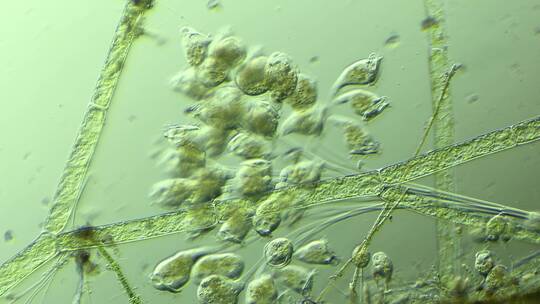 生命科学纪录片素材，显微镜下的生物钟虫1