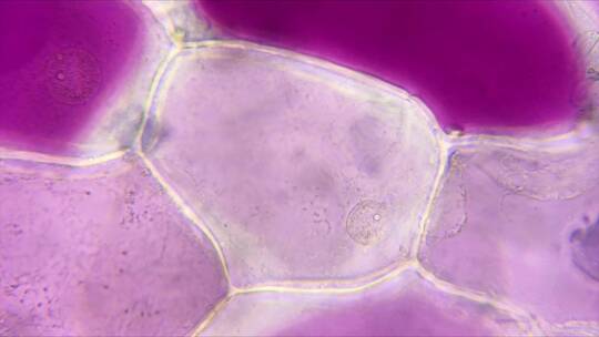 植物细胞细胞核（洋葱表皮细胞放大1000倍）