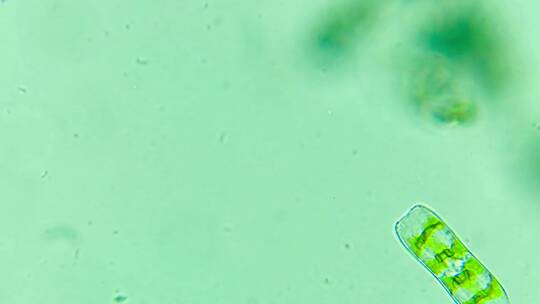 显微观察 移动的硅藻