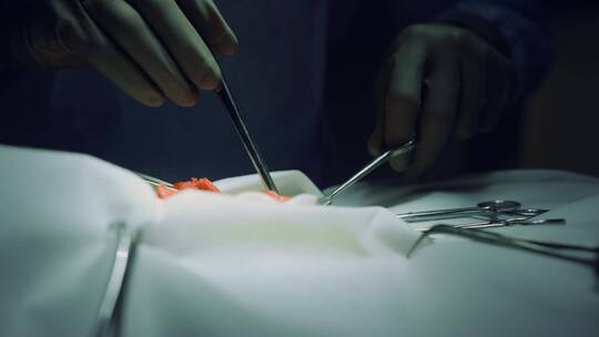 外科医生在手术室工作视频素材模板下载