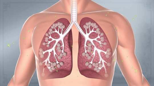 肺部粘膜  溃疡 气管炎  止咳肺病