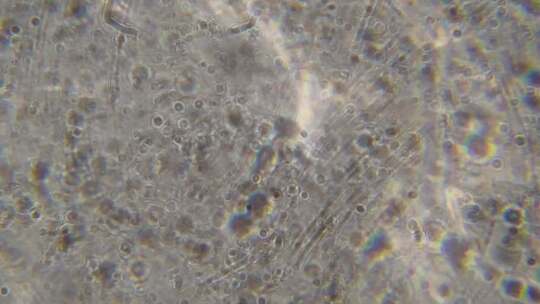 显微镜下精子运动5