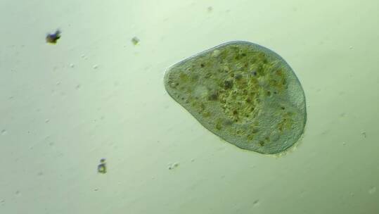 生命科学纪录片素材，显微镜下的喇叭虫1