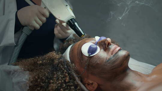美容师使用沙龙设备用激光特写手剥离女性皮