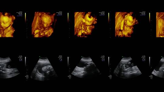 医疗设备的视频墙超声扫描诊断妊娠