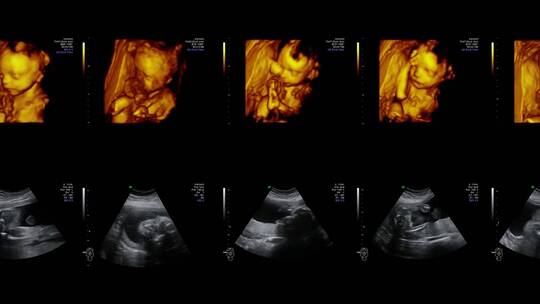 医疗设备的视频墙超声扫描诊断妊娠视频素材模板下载