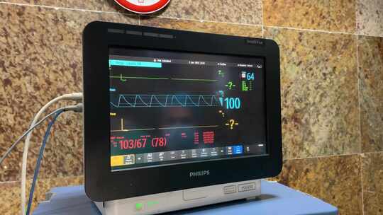 医院病房心电图显示器