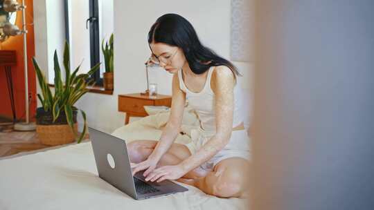 白癜风，卧室，床，笔记本电脑