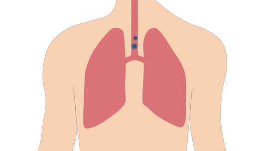 人类呼吸系统和肺部的病毒、冠状病毒或新冠