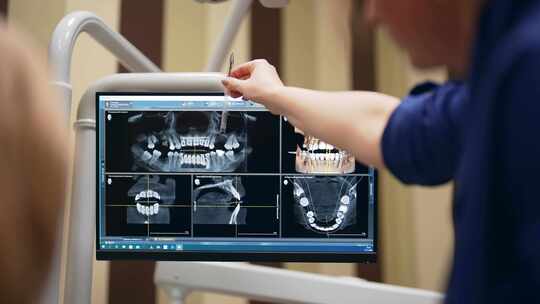 牙医对牙科病人解说X光片视频素材模板下载
