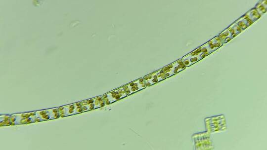 生物科普科研素材 连成一串的硅藻1