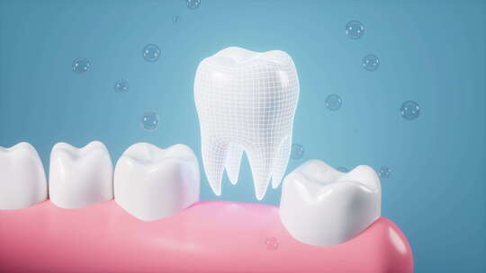 人类牙齿修复假牙植入牙齿动画
