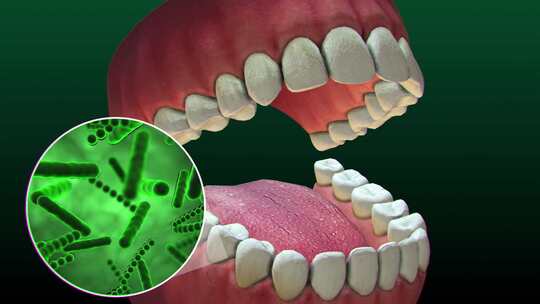 牙齿周围的细菌和病毒