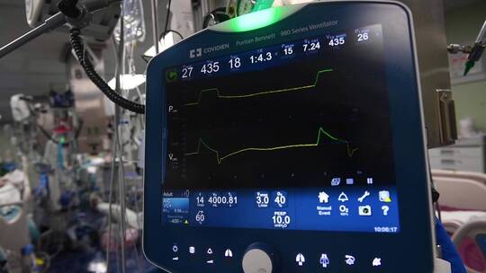 医院工作的监护仪器视频素材模板下载