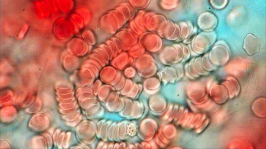 红细胞，显微，血细胞，人体