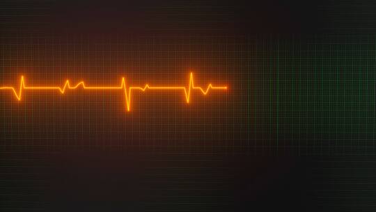 绿色屏幕上的心脏图曲线