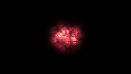 4k树状的血管红色球眼球 (5)