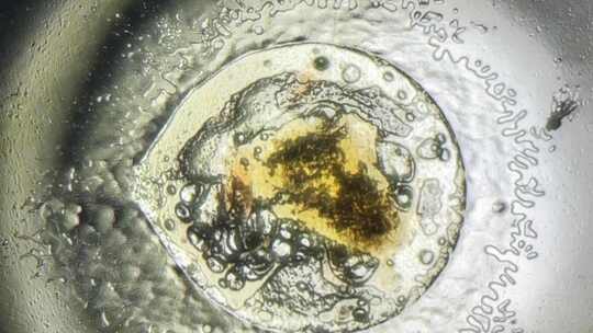 显微镜下的山楂细胞