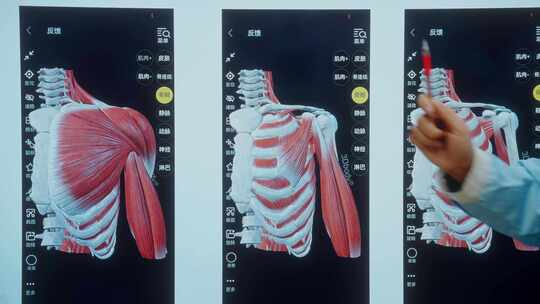 人体肩部肌肉骨骼3D模型展示