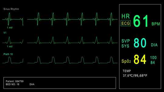 循环：患者监护仪显示生命体征心电图心电图