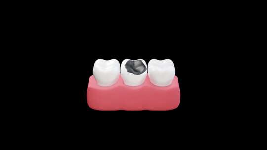 修复损坏的牙齿三维动画视频素材模板下载