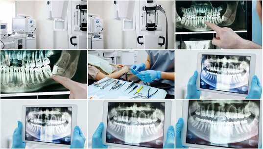 牙科医生高清在线视频素材下载