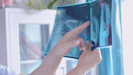 骨折手脚腿伤缝线包扎15