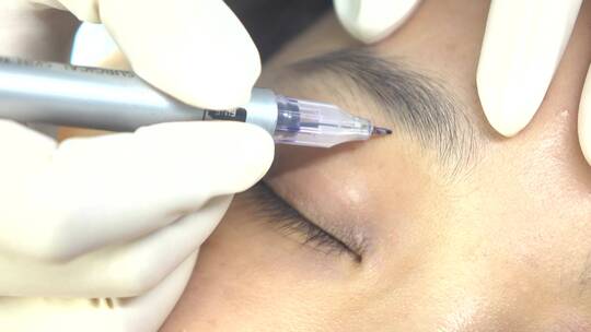 医美美容院整形作业画面