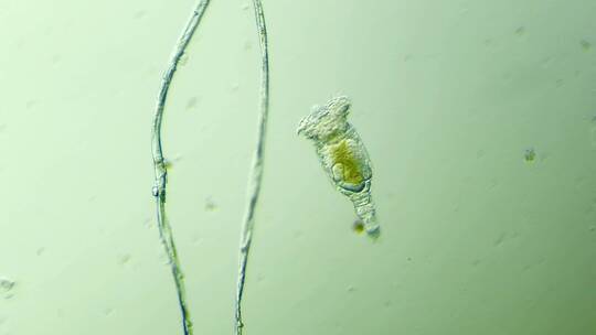 生命科学纪录片素材，显微镜下的生物，轮虫10
