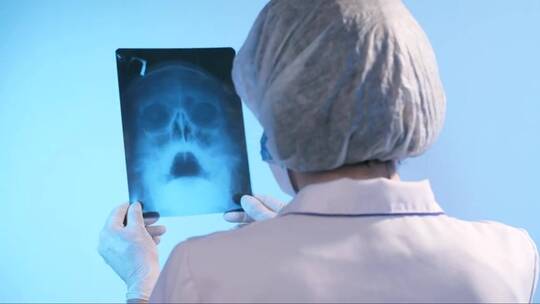 女医生在看头骨的x光片视频素材模板下载