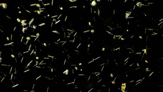 显微镜下的微生物硅藻合集