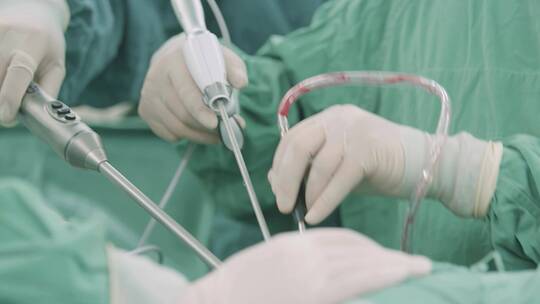 外科手术 做手术 抢救病人视频素材模板下载