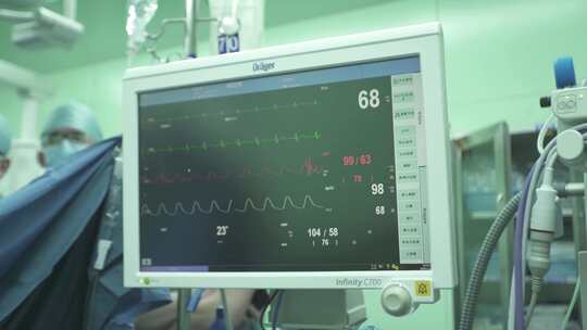 医院 手术室 监测仪器 心电图