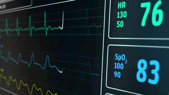 心电图心脏跳动监测器在医院循环和无缝