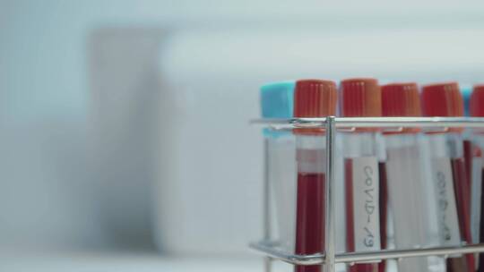 实验室里的血液试管视频素材模板下载