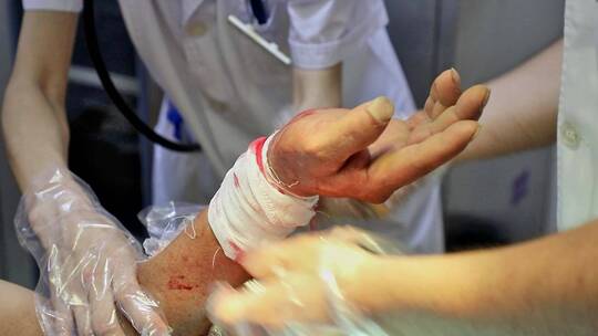 医院急诊科医生包扎患者伤口视频素材模板下载