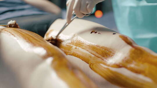 穿蓝色外套和白手套的医生在静脉手术前在腿视频素材模板下载