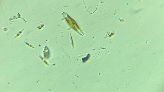 显微镜下的微观世界微生物 硅藻5