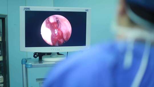 手术 医生 腔镜 手术室 患者 鼻科视频素材模板下载