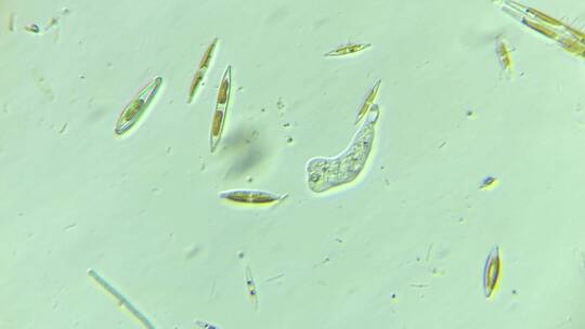 显微镜下的微观世界微生物 硅藻3