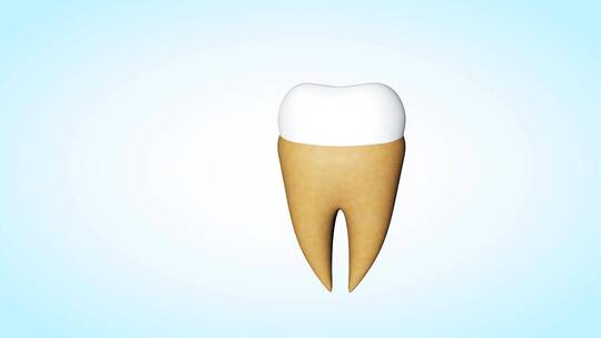 人体牙齿牙结石三维动画