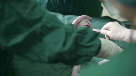 新生儿脐带处理婴儿啼哭视频素材模板下载