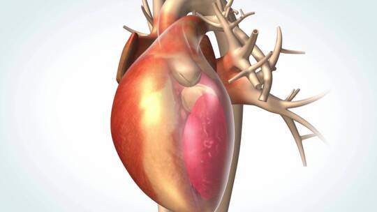 经导管心脏主动脉瓣置入术