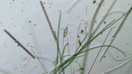显微镜下放大100倍的漂亮微观世界颤藻眼虫和硅藻微分干涉DIC