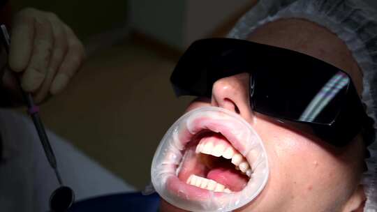 年轻女性患者接受牙医的牙齿清洁牙医仔细刷视频素材模板下载