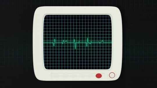 绿色屏幕上的心脏图曲线