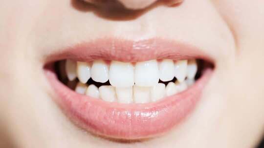 种植牙片头牙科诊所牙齿护理牙齿美白